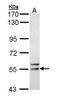 Fyn Related Src Family Tyrosine Kinase antibody, GTX111430, GeneTex, Western Blot image 