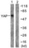 Zinc Finger Protein 543 antibody, orb313478, Biorbyt, Western Blot image 