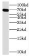 Alpha-1,3-Mannosyl-Glycoprotein 4-Beta-N-Acetylglucosaminyltransferase A antibody, FNab05159, FineTest, Western Blot image 