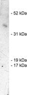 Siah E3 Ubiquitin Protein Ligase 1 antibody, MBS395429, MyBioSource, Western Blot image 