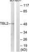 Transducin beta-like protein 2 antibody, TA315338, Origene, Western Blot image 
