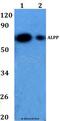 Alkaline Phosphatase, Placental antibody, LS-C411992, Lifespan Biosciences, Western Blot image 