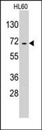 Glutamyl-TRNA Synthetase 2, Mitochondrial antibody, AP14223PU-N, Origene, Western Blot image 