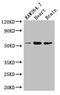 Phenylalanine Hydroxylase antibody, A63090-100, Epigentek, Western Blot image 