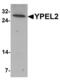 Yippee Like 2 antibody, LS-B8810, Lifespan Biosciences, Western Blot image 