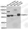 Sphingomyelin Phosphodiesterase 1 antibody, A6743, ABclonal Technology, Western Blot image 