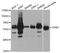 Asparagine Synthetase (Glutamine-Hydrolyzing) antibody, A03302, Boster Biological Technology, Western Blot image 