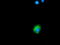 Sequestosome 1 antibody, LS-C172378, Lifespan Biosciences, Immunofluorescence image 