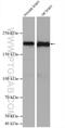 Ankyrin-3 antibody, 27980-1-AP, Proteintech Group, Western Blot image 