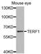 Telomeric Repeat Binding Factor 1 antibody, MBS125022, MyBioSource, Western Blot image 