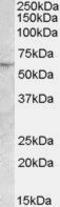 Patatin Like Phospholipase Domain Containing 2 antibody, GTX88804, GeneTex, Western Blot image 