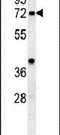 Kelch Like Family Member 6 antibody, PA5-25693, Invitrogen Antibodies, Western Blot image 