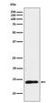 T Cell Leukemia/Lymphoma 1A antibody, M03713, Boster Biological Technology, Western Blot image 