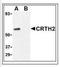 Prostaglandin D2 Receptor 2 antibody, NBP1-50452, Novus Biologicals, Western Blot image 