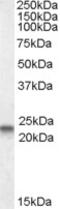 Cyclin Dependent Kinase 10 antibody, 46-980, ProSci, Western Blot image 