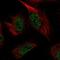 Pyridoxal Kinase antibody, NBP1-88283, Novus Biologicals, Immunocytochemistry image 