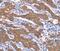 Serum/Glucocorticoid Regulated Kinase 2 antibody, MBS2519978, MyBioSource, Immunohistochemistry paraffin image 