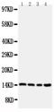 Cystatin B antibody, PA2106, Boster Biological Technology, Western Blot image 