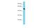 Mitochondrial import inner membrane translocase subunit TIM50 antibody, PA5-46303, Invitrogen Antibodies, Western Blot image 