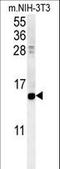 Cellular Retinoic Acid Binding Protein 1 antibody, LS-C167019, Lifespan Biosciences, Western Blot image 