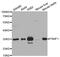 Proteasome Inhibitor Subunit 1 antibody, PA5-76755, Invitrogen Antibodies, Western Blot image 