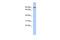 Aldehyde Dehydrogenase 18 Family Member A1 antibody, PA5-44509, Invitrogen Antibodies, Western Blot image 