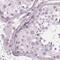 Progestagen Associated Endometrial Protein antibody, PA5-54152, Invitrogen Antibodies, Immunohistochemistry frozen image 