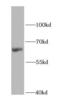 VICKZ family member 2 antibody, FNab04172, FineTest, Western Blot image 