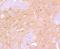 B-Raf Proto-Oncogene, Serine/Threonine Kinase antibody, NBP2-67469, Novus Biologicals, Immunohistochemistry paraffin image 