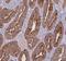 Acyl-CoA Synthetase Family Member 2 antibody, FNab00105, FineTest, Immunohistochemistry paraffin image 