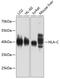 HLA class I histocompatibility antigen, Cw-7 alpha chain antibody, GTX64539, GeneTex, Western Blot image 