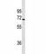 Cytochrome P450 Family 1 Subfamily A Member 2 antibody, F40373-0.4ML, NSJ Bioreagents, Western Blot image 