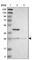 Ankyrin Repeat And SOCS Box Containing 9 antibody, HPA003014, Atlas Antibodies, Western Blot image 