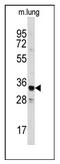 Annexin A3 antibody, AP12481PU-N, Origene, Western Blot image 