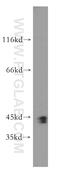 SWI/SNF Related, Matrix Associated, Actin Dependent Regulator Of Chromatin, Subfamily B, Member 1 antibody, 20654-1-AP, Proteintech Group, Western Blot image 