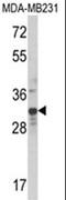 MAX Dimerization Protein MLX antibody, AP18116PU-N, Origene, Western Blot image 