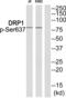 Collapsin Response Mediator Protein 1 antibody, PA5-37534, Invitrogen Antibodies, Western Blot image 