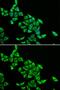 Dihydrolipoamide S-Acetyltransferase antibody, GTX54002, GeneTex, Immunocytochemistry image 