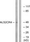 Transmembrane Protein 237 antibody, A30569, Boster Biological Technology, Western Blot image 