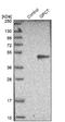 Glutaminyl-Peptide Cyclotransferase antibody, NBP1-81838, Novus Biologicals, Western Blot image 
