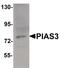 Protein Inhibitor Of Activated STAT 3 antibody, PA5-20953, Invitrogen Antibodies, Western Blot image 