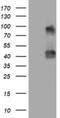 Neuraminidase 1 antibody, NBP2-46152, Novus Biologicals, Western Blot image 