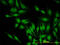 PDZ Binding Kinase antibody, LS-C133785, Lifespan Biosciences, Immunofluorescence image 
