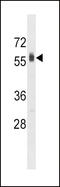 Sphingosine Kinase 2 antibody, 62-750, ProSci, Western Blot image 