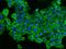 EGFR antibody, 10001-MM08T, Sino Biological, Immunohistochemistry frozen image 