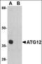 Autophagy Related 12 antibody, orb88746, Biorbyt, Western Blot image 