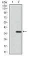 ATP Binding Cassette Subfamily G Member 5 antibody, MA5-24799, Invitrogen Antibodies, Western Blot image 