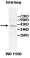 Archaelysin Family Metallopeptidase 2 antibody, MBS855488, MyBioSource, Western Blot image 