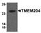 Transmembrane Protein 204 antibody, orb75640, Biorbyt, Western Blot image 