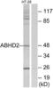 Abhydrolase Domain Containing 2 antibody, LS-B9699, Lifespan Biosciences, Western Blot image 